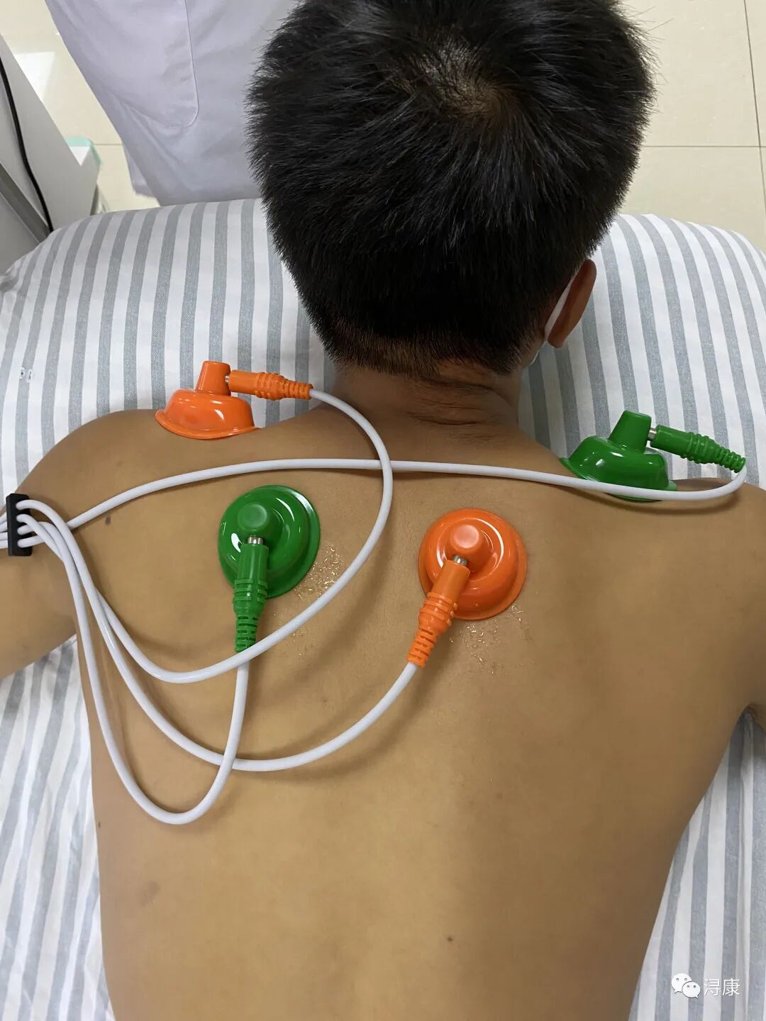 中频为什么能镇痛疼痛克星，解痉神器——中频干扰电_https://www.jmylbn.com_新闻资讯_第5张