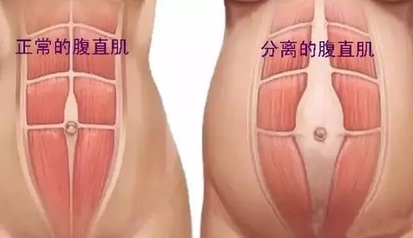 产后都卸货了，为啥肚子还是收不回来？