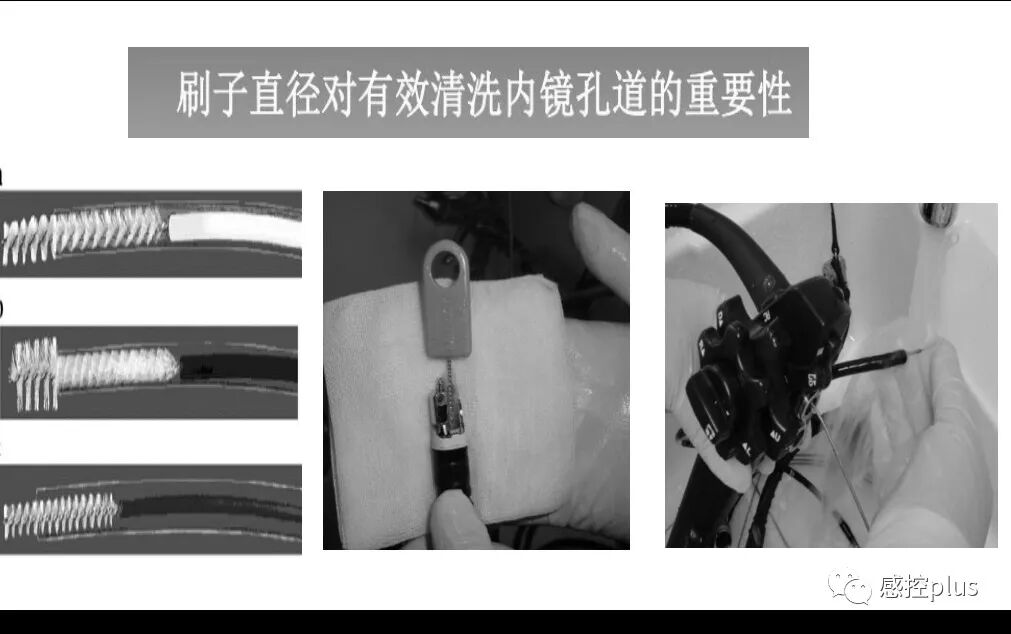 喉镜器怎么清洗软式内镜的清洗消毒_https://www.jmylbn.com_新闻资讯_第5张