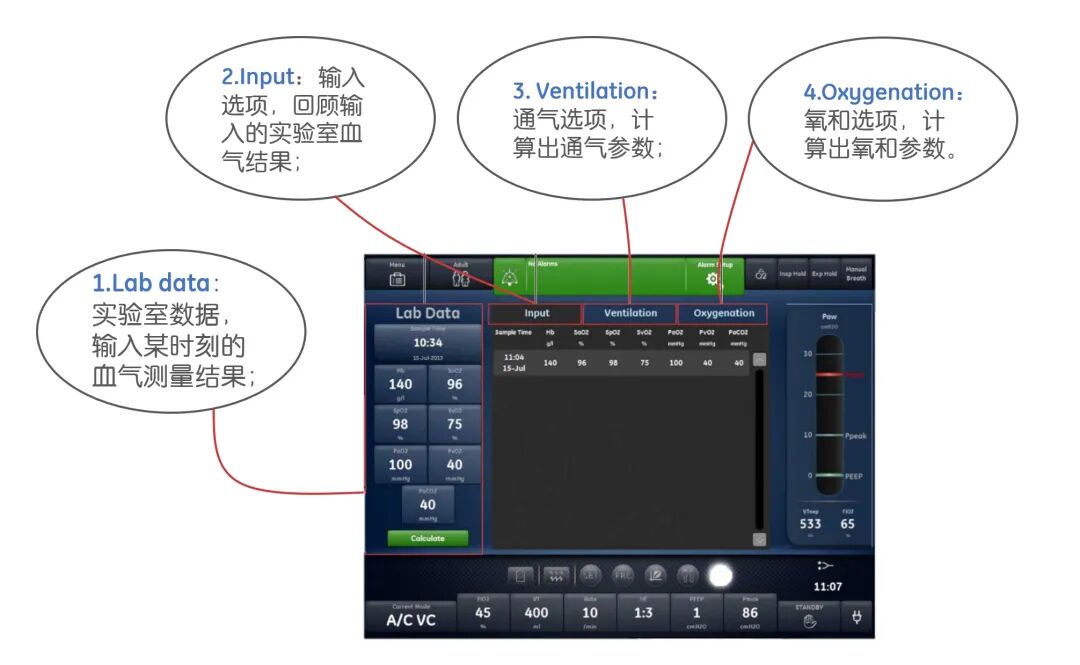 vt在医学上什么意思关于死腔分数或死腔通气比（VD／VT），你了解多少？_https://www.jmylbn.com_新闻资讯_第2张