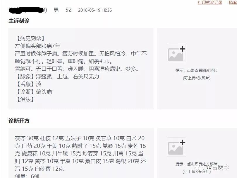 偏头痛 阳虚水逆 董古医堂 微信公众号文章阅读 Wemp