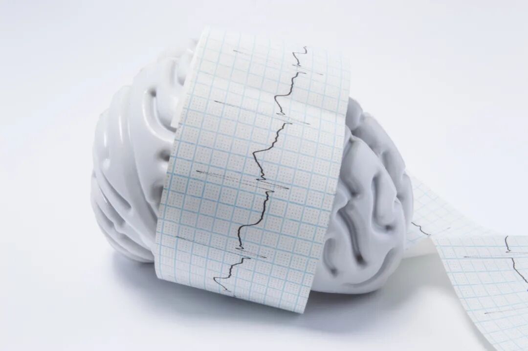 生酮饮食对难治性癫痫儿童认知功能的影响