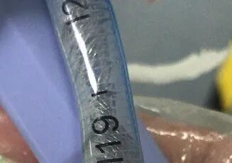 加强器官插管怎么用紧急！吸痰管放不进气道！_https://www.jmylbn.com_新闻资讯_第14张