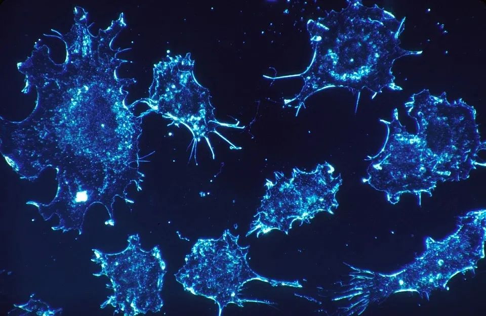 细胞焦亡突击，未来抗癌战场的炸药包？