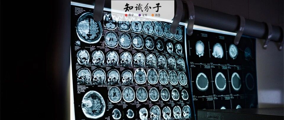 新冠病毒感染前后大脑有哪些变化？