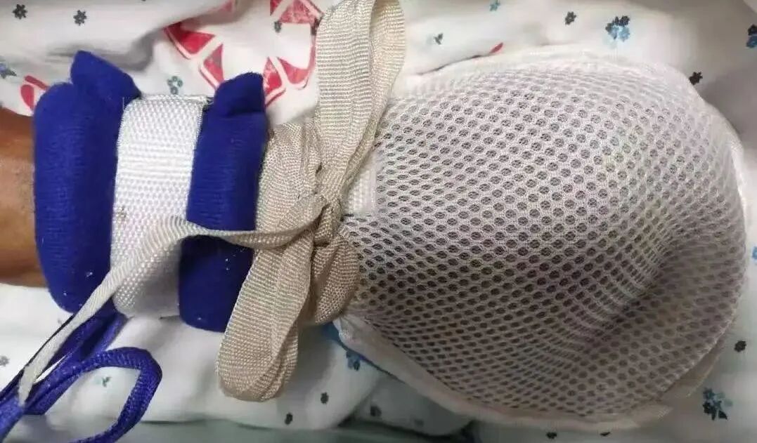 为什么使用注射泵医生，你为什么要把我父亲“绑”起来？_https://www.jmylbn.com_新闻资讯_第7张