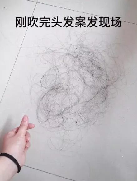 拯救发际线大作战，摆“脱”烦恼！