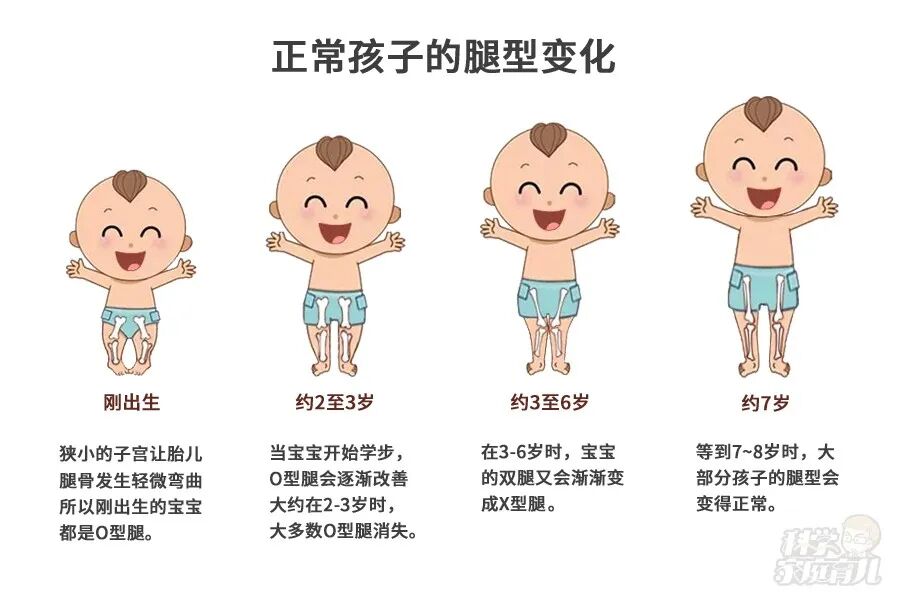 认准一个数字,自查不良腿型!