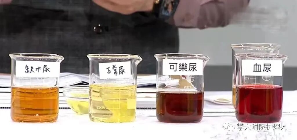 弯头导尿管怎么用小小尿管作用大，自行拔出危害大！_https://www.jmylbn.com_新闻资讯_第32张