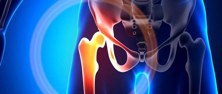 髋关节，人体最怕“摔”的部位！5类人的「胯」格外脆