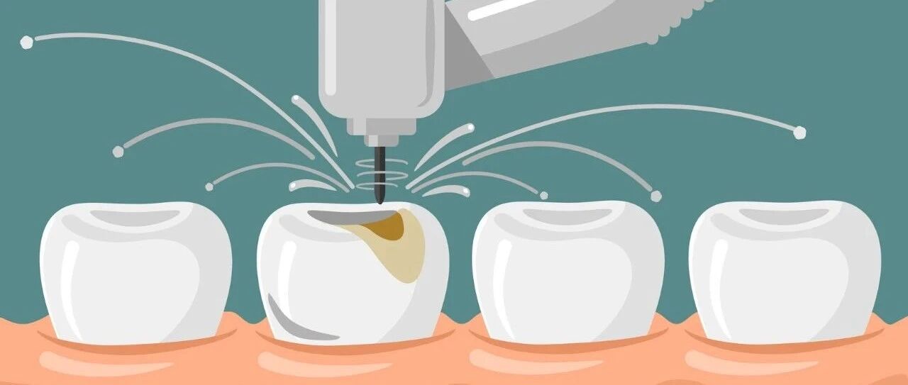 人人有颗“隐藏”的龋齿！口腔科医生：最易“蛀”的地方你刷不到