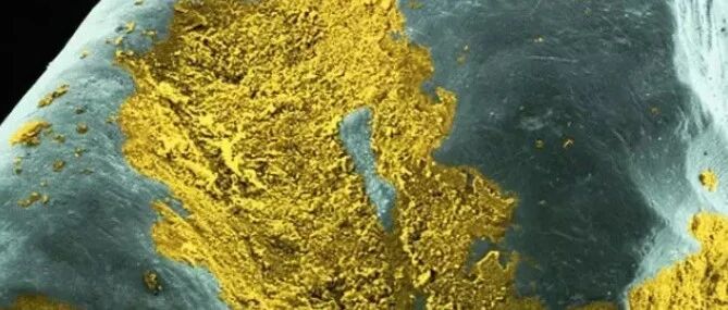 将牙齿放大1000倍，让你看到它最真实的模样……