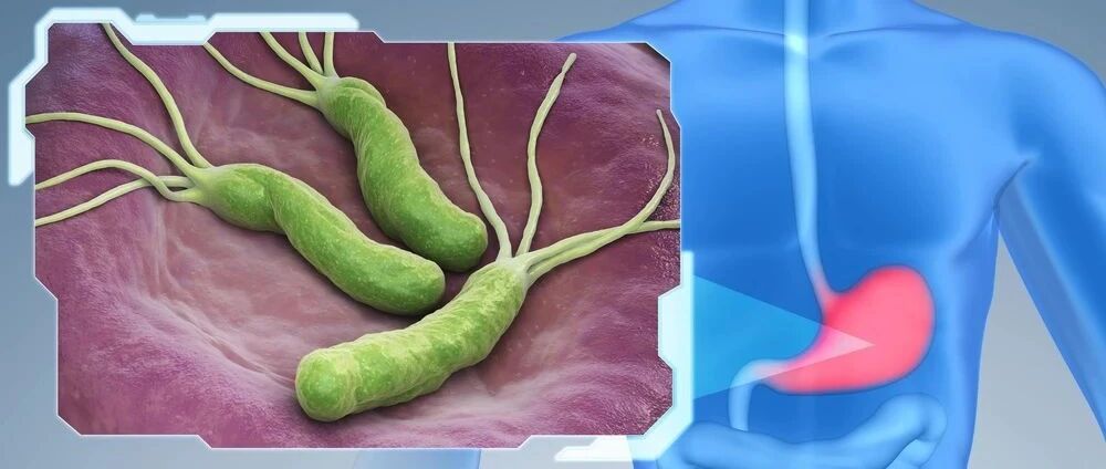 幽门螺杆菌又有“新罪名”：影响血压！常做4件事的人易感染