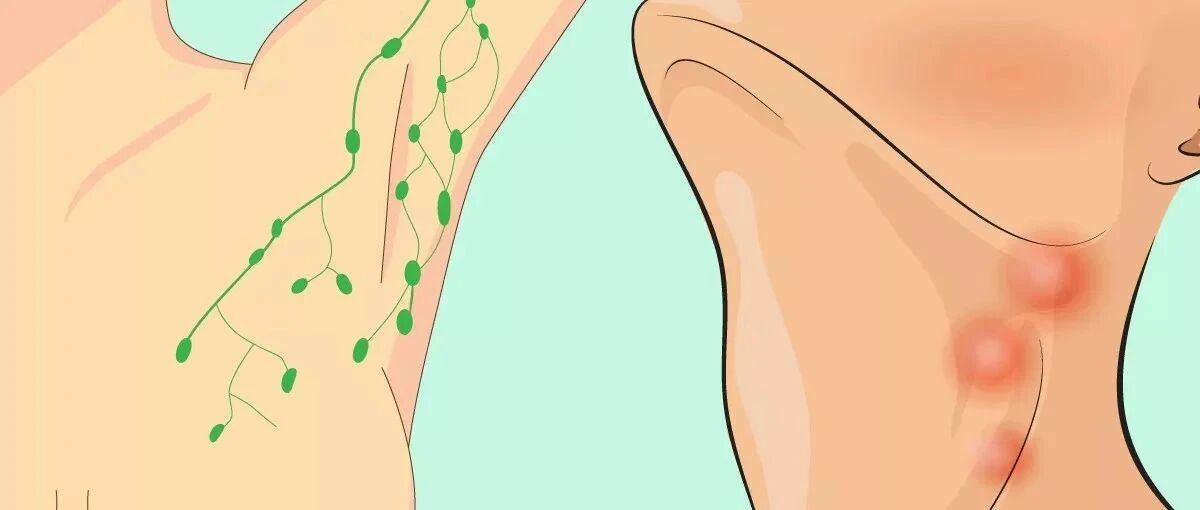 淋巴肿了，疼比不疼好！危险的淋巴结有6个特点