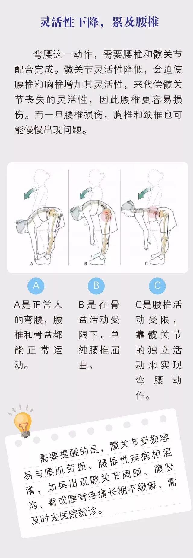 收藏这份「髋关节保养指南」