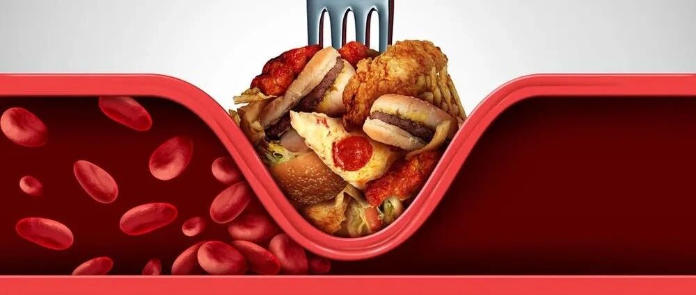 营养师把食物分3个等级，照着吃悄悄降低你的血脂