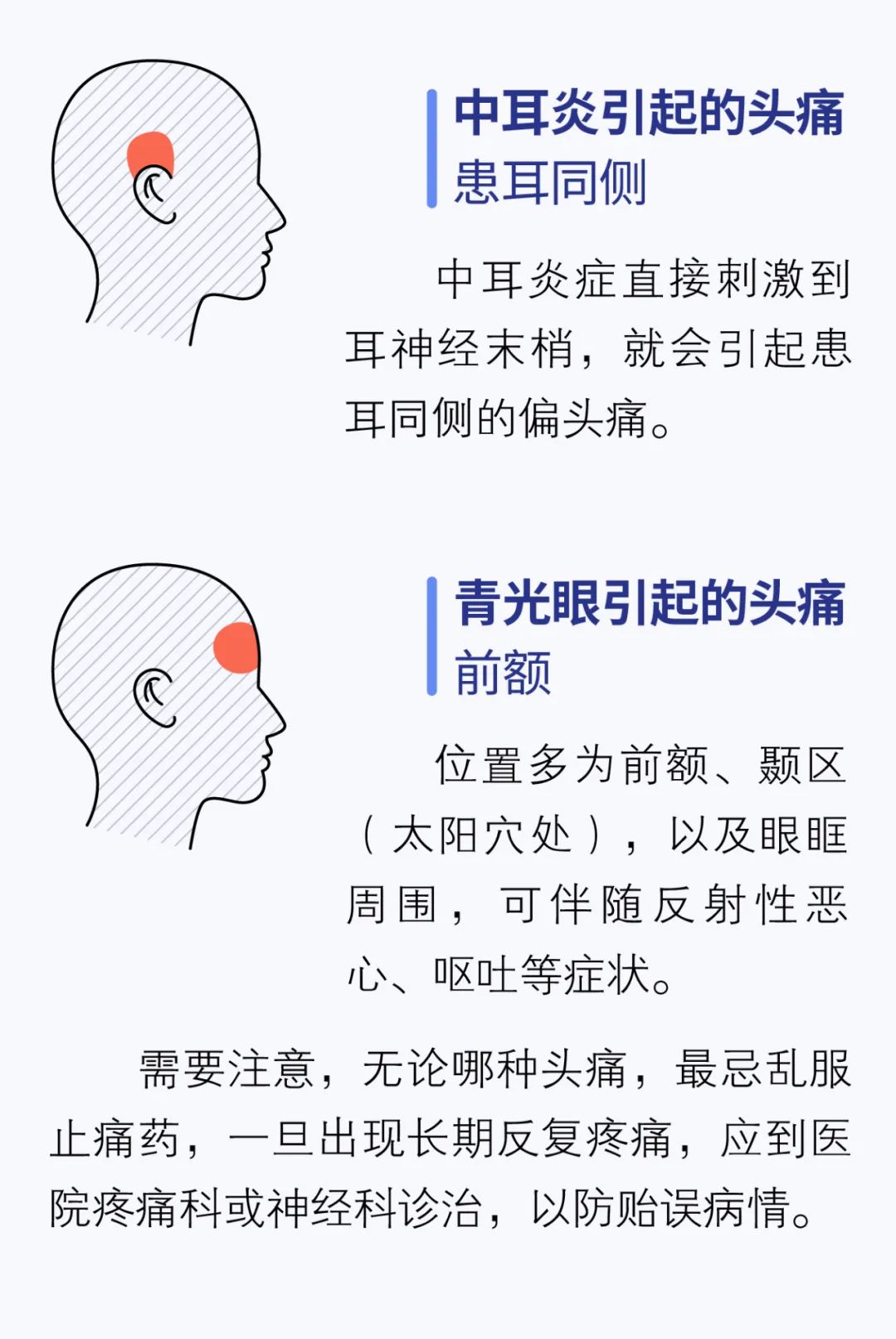 头痛部位对应的原因图解