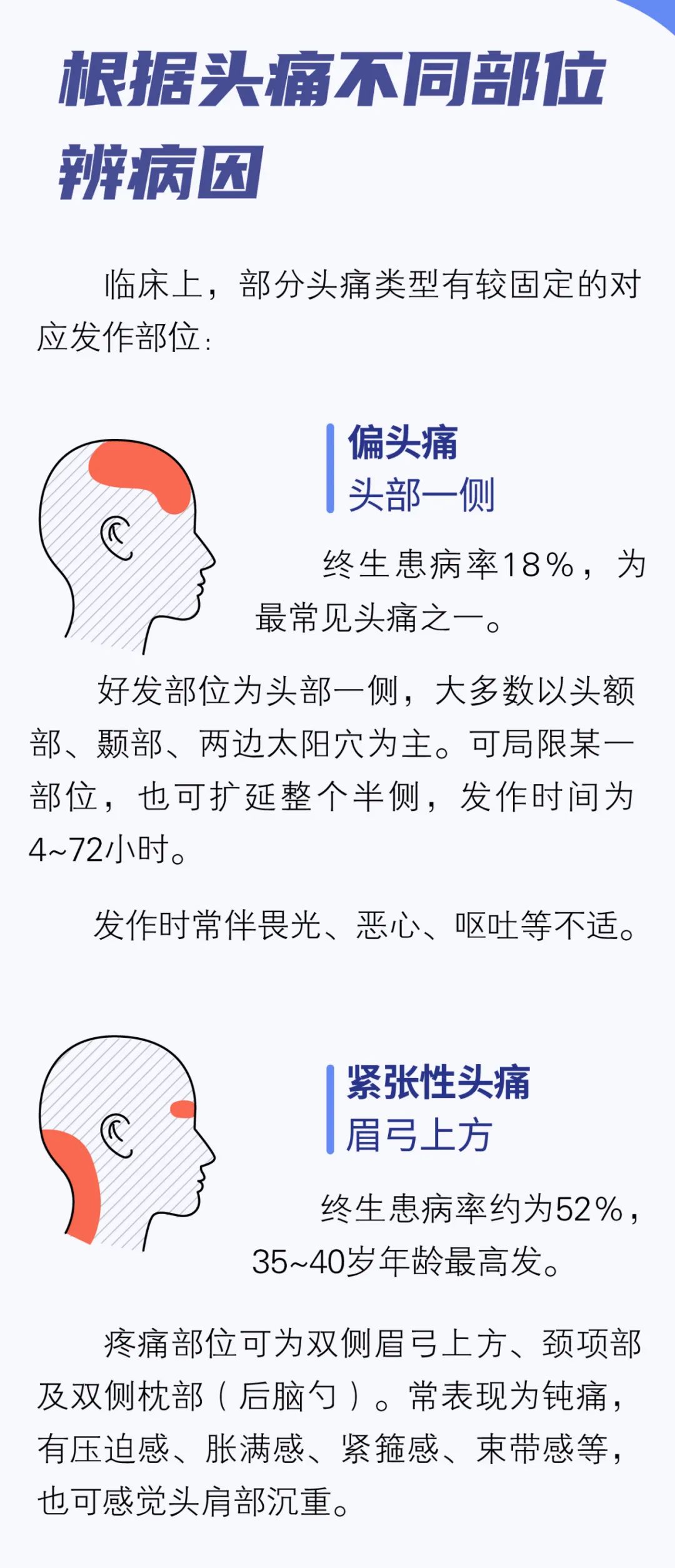 头痛部位对应的原因图解