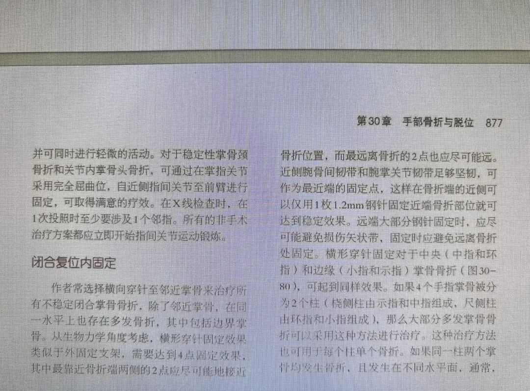 万能克氏针支架“隔山打牛”——掌骨骨折最实用的技术