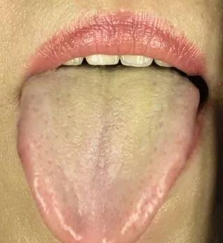 舌头告诉你的6个健康秘密 - 欧了~~小沈阳的主页