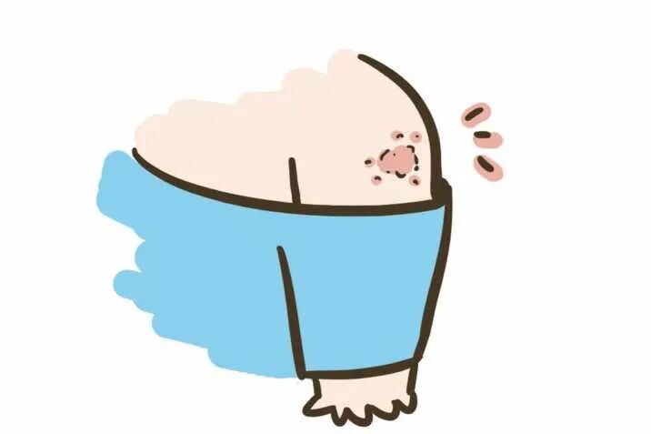 疫苗接种，家长最关心的7大问题看过来