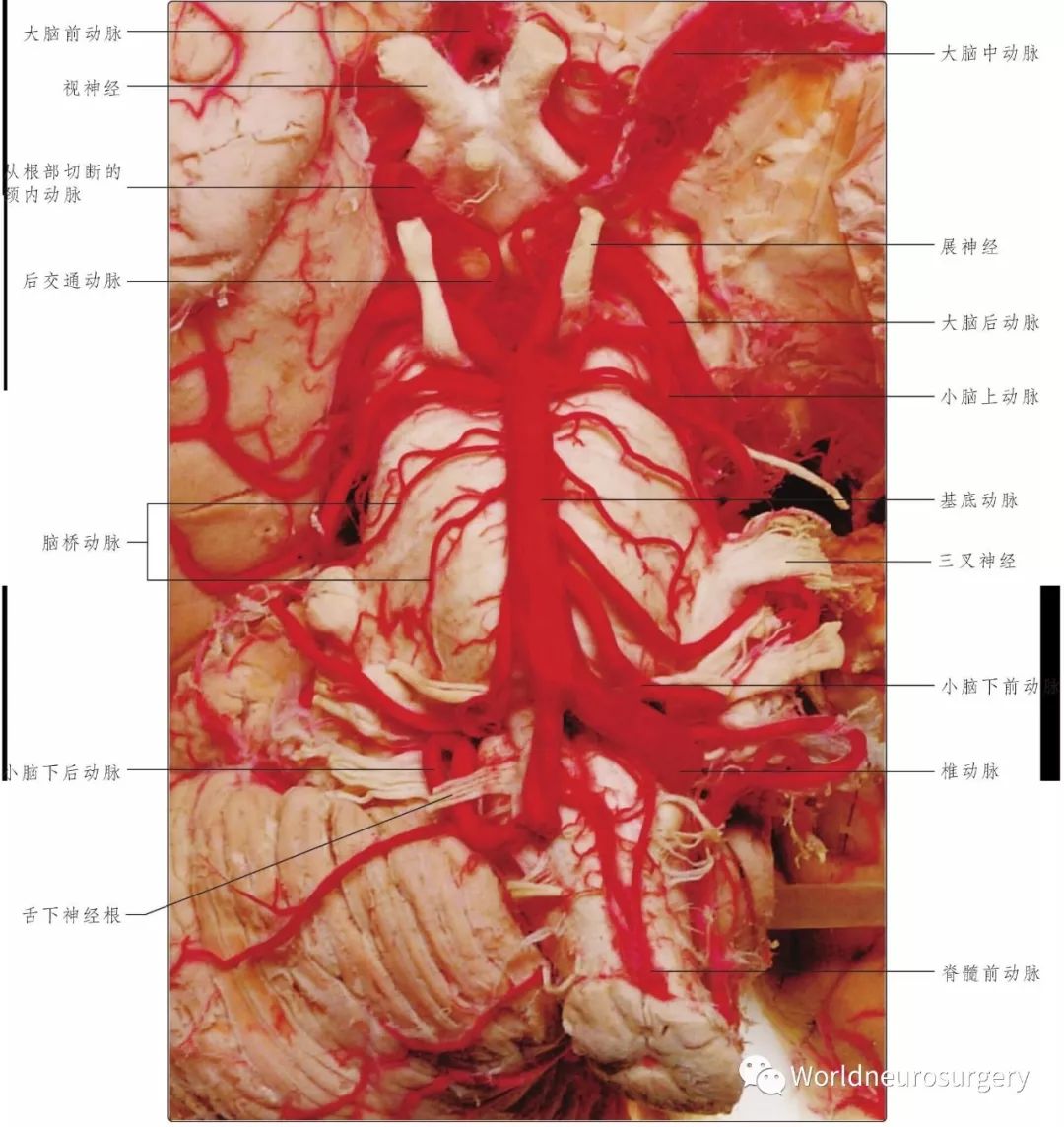 彩圖經典版 大腦及脊髓的血管解剖 Worldneurosurgery 微文庫