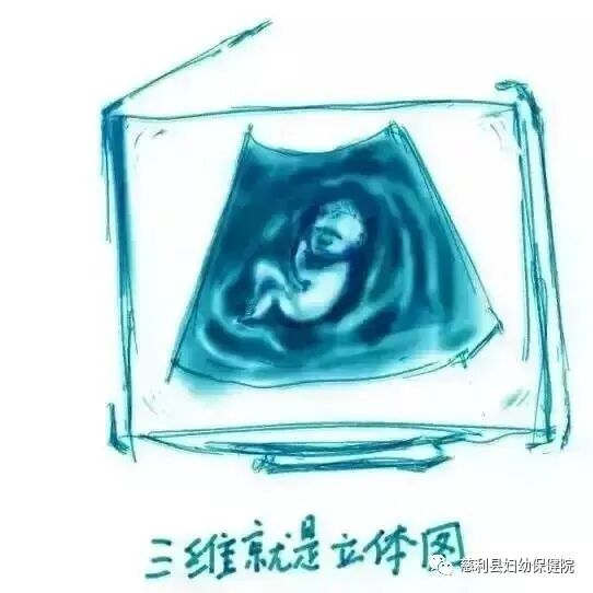 ge彩超怎么样“美国GE-E10”四维彩超界的战斗机—孕妈妈的首选！_https://www.jmylbn.com_新闻资讯_第4张