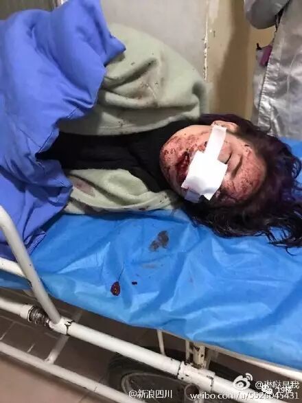 女子自曝受伤惨照网友爆料原文该网友还称,自己在被打时烧烤店老板并