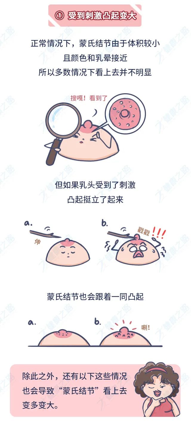 乳房周围长小颗粒图片