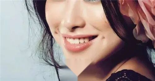 开封誉美医疗美容整形医院发际线植发多久可以恢复？