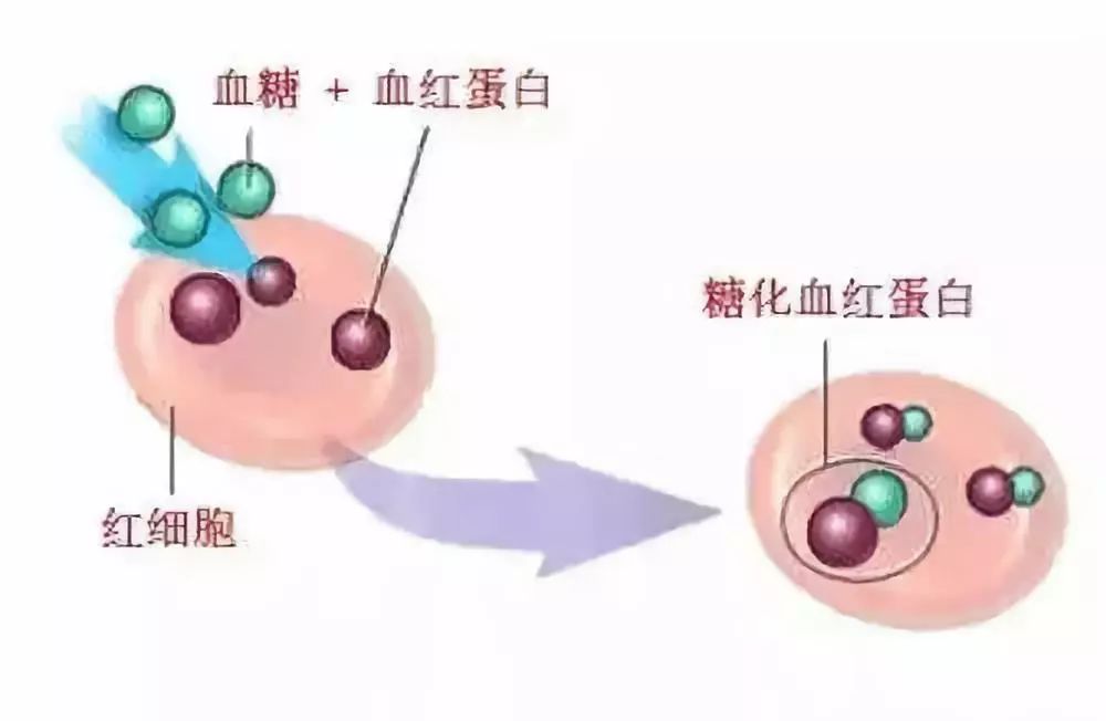 重磅！糖尿病降糖標準變了，你必須知道這些 健康 第2張