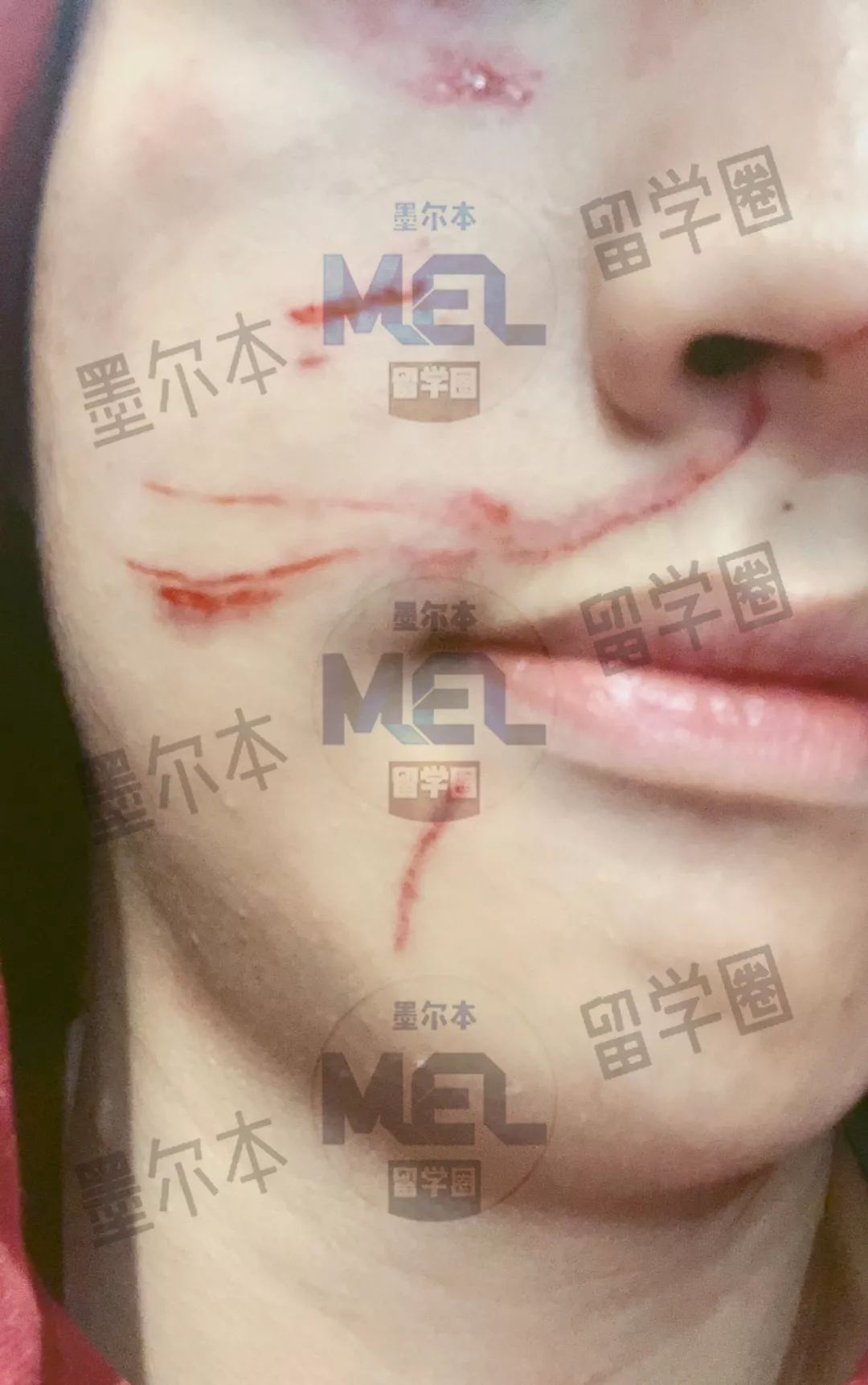 中国留学生在市区遭澳流浪汉袭击，被抓满脸血！叫嚣：要弄死中国人（组图） - 9