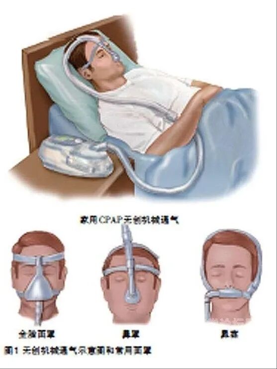 呼吸机传感器是什么解读 ｜ 关于呼吸机，你想知道的都在这里了_https://www.jmylbn.com_新闻资讯_第8张