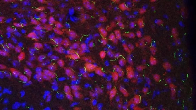 只要打开 1 个基因,你就瘦了 只要打开 1 个基因,你就瘦了