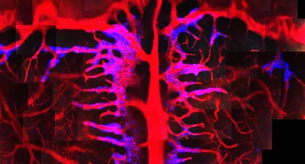 Nature:研究揭示白血病细胞入侵大脑新路径 Nature:研究揭示白血病细胞入侵大脑新路径