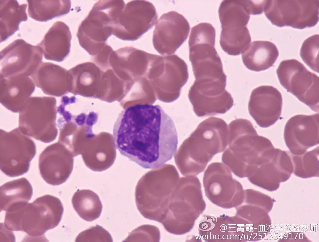 王老师看细胞之中性粒细胞集