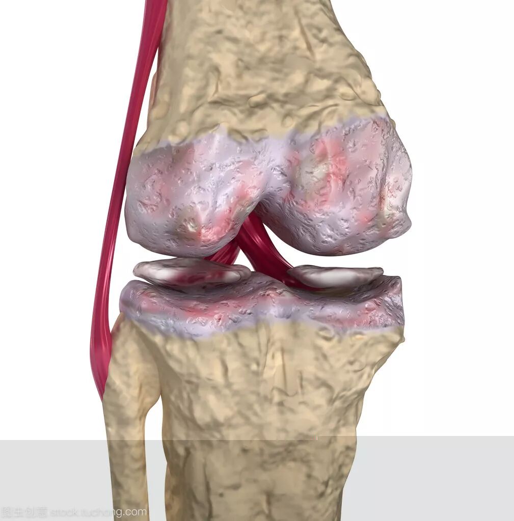 给你的骨头补点肽！