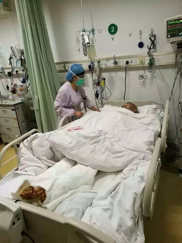 了都没事,唯独老宋吃了以后肚子痛,更是在两天后病危,直接进了icu抢救