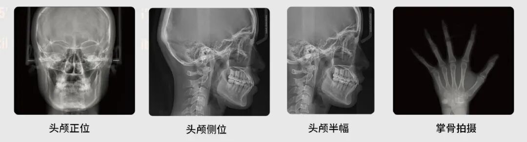 口腔ct什么牌子好黑科技口腔CT助力医院跑好2023年开局“第一棒”_https://www.jmylbn.com_新闻资讯_第7张