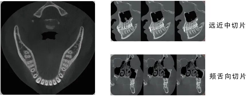 口腔ct什么牌子好黑科技口腔CT助力医院跑好2023年开局“第一棒”_https://www.jmylbn.com_新闻资讯_第5张