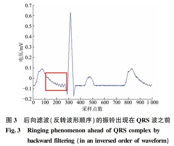 心电图滤波怎么选择振铃现象对心电图分析和诊断的影响_https://www.jmylbn.com_新闻资讯_第5张