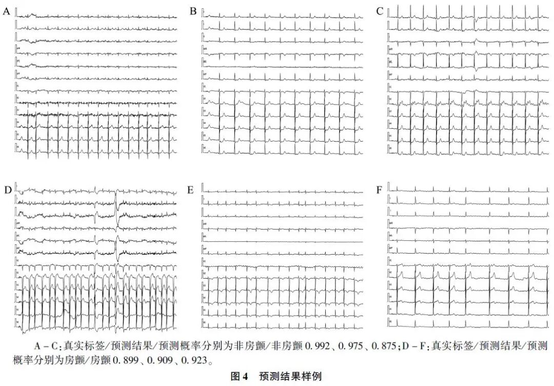 心电图纸怎么看【心电AI】从纸质心电图中识别房颤的人工智能算法研究_https://www.jmylbn.com_新闻资讯_第9张