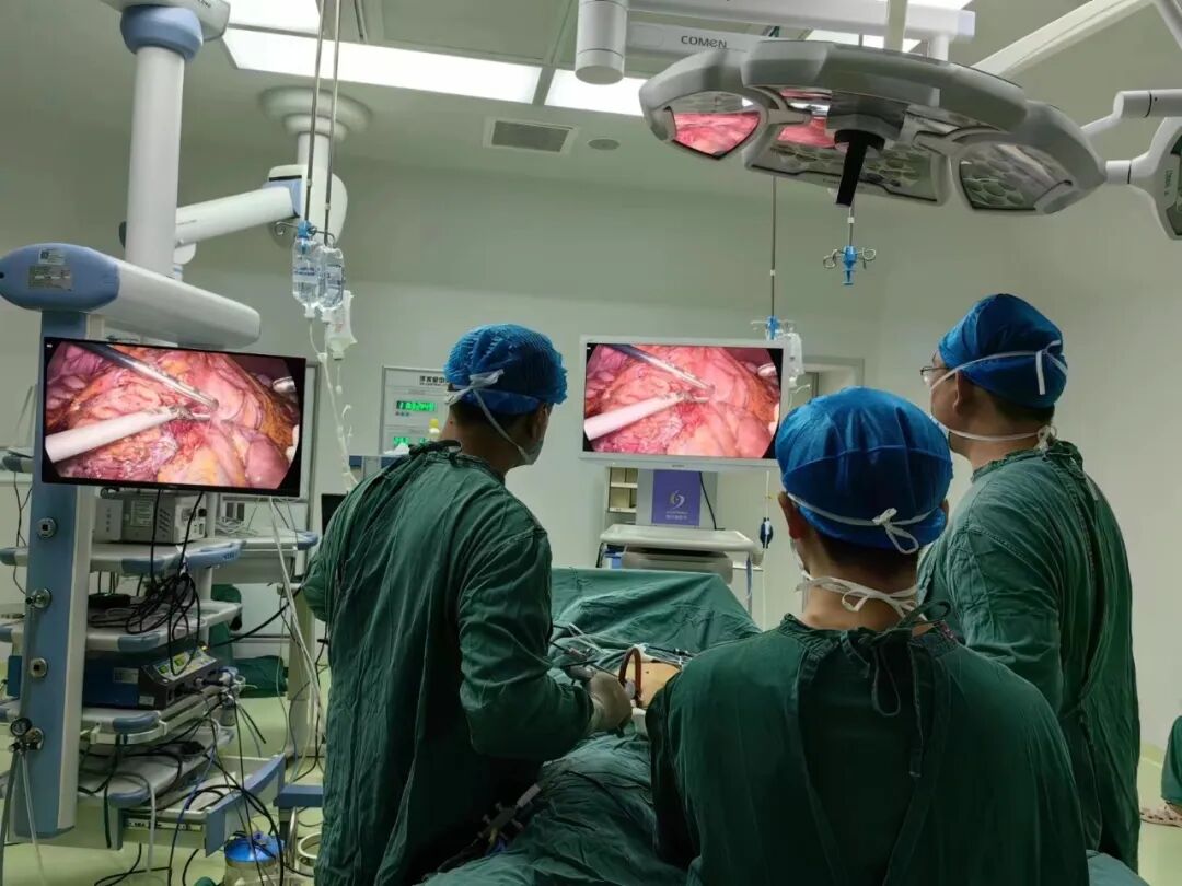 持续进步州人民医院普外科成功完成首例腹腔镜下胰十二指肠手术
