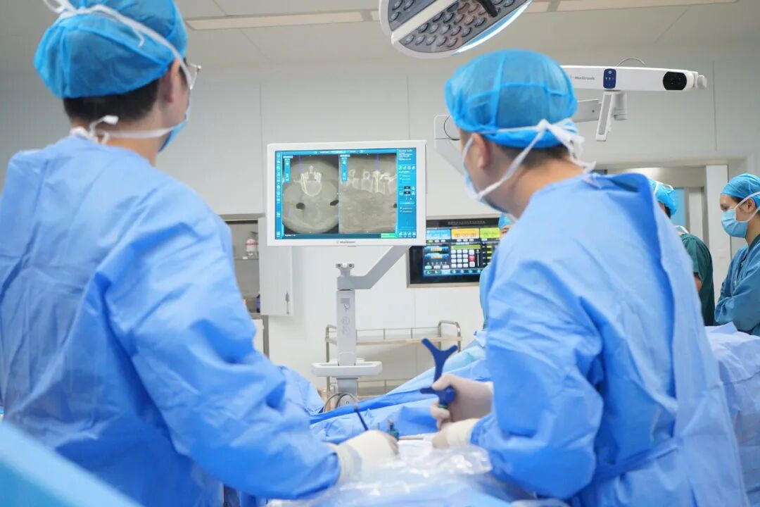 什么是c型臂术中透视手术中的“3D导航”—我院骨科成功实施两台O型臂透视术中导航下脊柱手术_https://www.jmylbn.com_新闻资讯_第3张