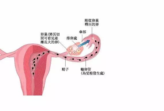 护阴器是什么东西阴道的自我防护？_https://www.jmylbn.com_新闻资讯_第3张