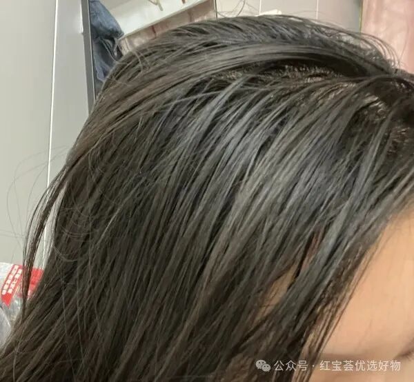 二硫化硒洗发水的功效？头发出油及产生头皮屑的原因？什么是二硫化硒？