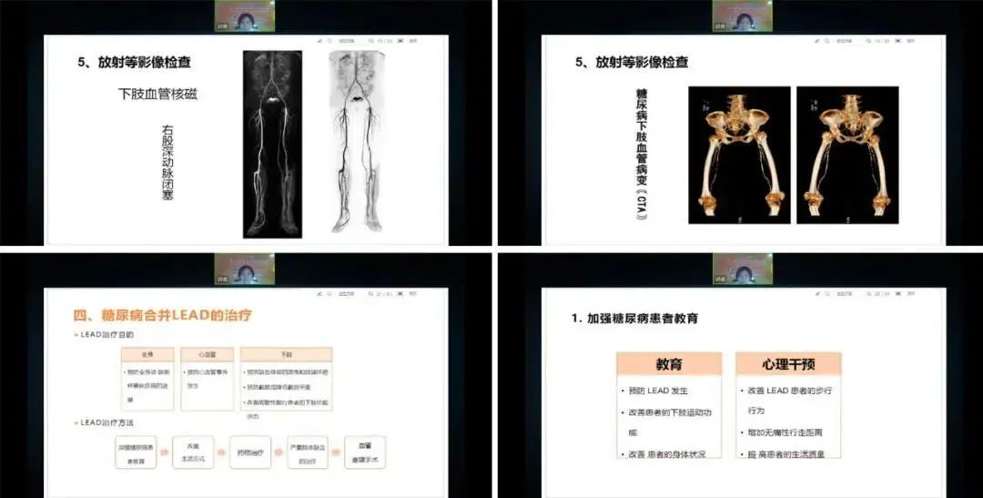 改善慢病管理，彰顯大醫智慧——第八屆糖尿病共同照護論壇（北京站）圓滿結束！ 健康 第10張