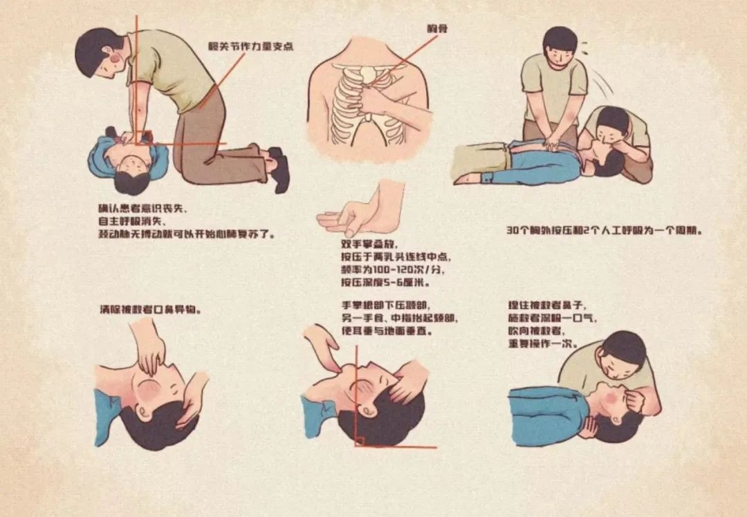重后果。若发现同伴已出现心跳、呼吸骤停，则需立即对其进行心肺复苏。