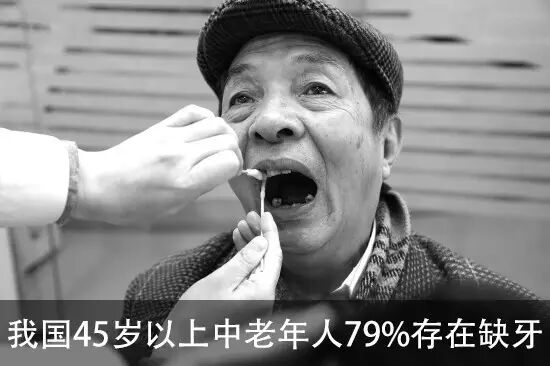 震惊！缺牙者人均寿命比牙全者短11年？缺牙不补，后果居然这么