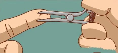 为什么叫哈巴狗钳外科手术特色武器——哈巴狗夹_https://www.jmylbn.com_新闻资讯_第3张